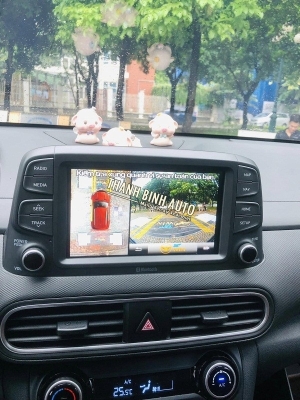 Camera 360 Owin cho xe Hyundai Kona